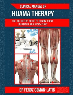 Clinical Manual of Hijama Therapy 1