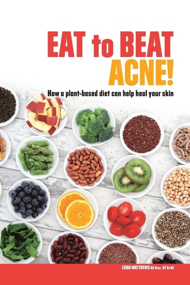 bokomslag Eat to Beat Acne!