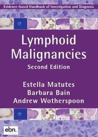 bokomslag Lymphoid Malignancies