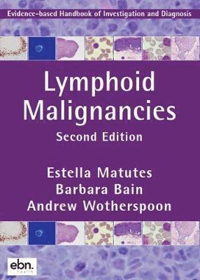 Lymphoid Malignancies 1