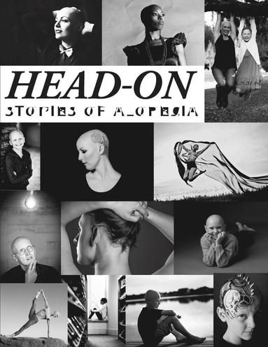 bokomslag Head-On, Stories of Alopecia