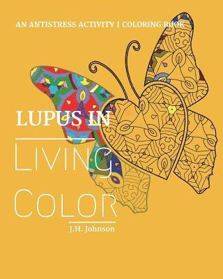 J H Johnson, J. H. Johnson, J.H. Johnson - Lupus in Living Color, Häftad