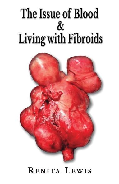 bokomslag Issue Of Blood & Living with Fibroids