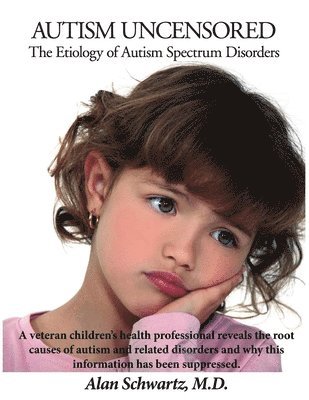 Alan Schwartz MD - Autism Uncensored: The Etiology of Autism Spectrum Disorders, Häftad