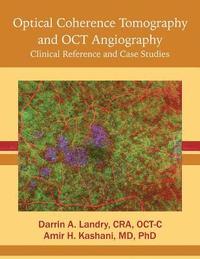 bokomslag Optical Coherence Tomography and OCT Angiography: Clinical Reference and Case Studies