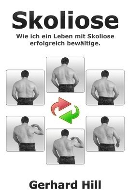 Gerhard Hill, Ralf Koch - Skoliose, Häftad