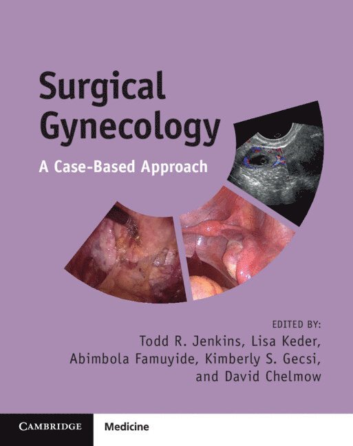 Todd R. Jenkins, Lisa Keder, Abimola Famuyide, Kimberly S. Gecsi, David Chelmow, Birmingham) Jenkins, Todd R. (University of Alabama, Todd R Jenkins, Kimberly S Gecsi - Surgical Gynecology, Häftad