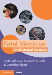 bokomslag Fetal Medicine