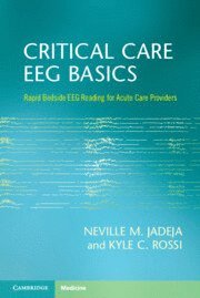 bokomslag Critical Care EEG Basics