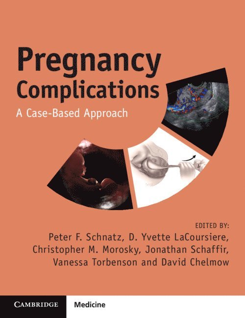 Pregnancy Complications 1