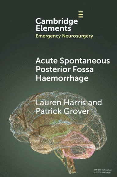 bokomslag Acute Spontaneous Posterior Fossa Haemorrhage