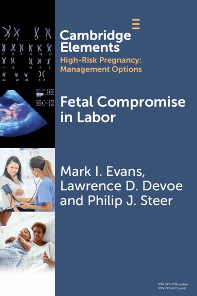 Mark I. Evans, Lawrence D. Devoe, Philip J. Steer - Fetal Compromise in Labor, Häftad