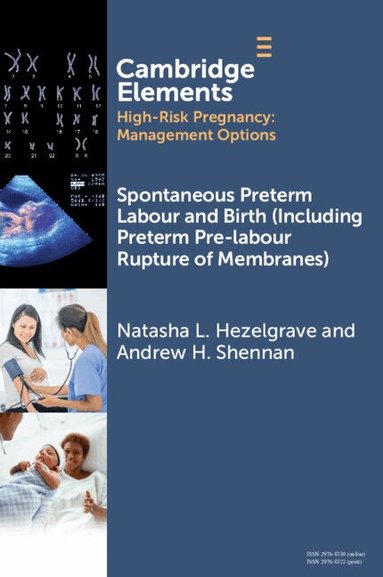 Natasha L. Hezelgrave, Andrew Shennan - Spontaneous Preterm Labour and Birth (Including Preterm Pre-labour Rupture of Membranes), Häftad