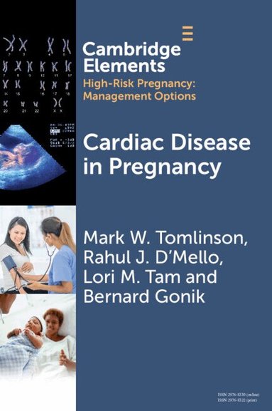 Mark W. Tomlinson, Rahul J. D'Mello, Lori M. Tam, Bernard Gonik - Cardiac Disease in Pregnancy, Häftad