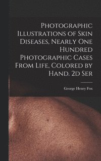 bokomslag Photographic Illustrations of Skin Diseases, Nearly One Hundred Photographic Cases From Life, Colored by Hand. 2d Ser