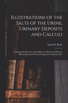 Illustrations of the Salts of the Urine, Urinary Deposits and Calculi
