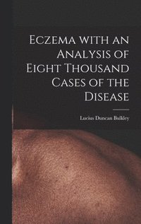 bokomslag Eczema With an Analysis of Eight Thousand Cases of the Disease