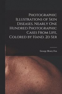 bokomslag Photographic Illustrations of Skin Diseases, Nearly One Hundred Photographic Cases From Life, Colored by Hand. 2d Ser