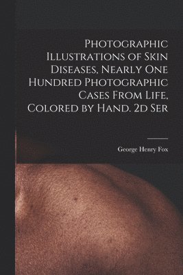 Photographic Illustrations of Skin Diseases, Nearly One Hundred Photographic Cases From Life, Colored by Hand. 2d Ser 1