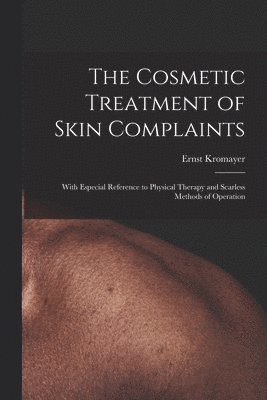 The Cosmetic Treatment of Skin Complaints: With Especial Reference to Physical Therapy and Scarless Methods of Operation 1