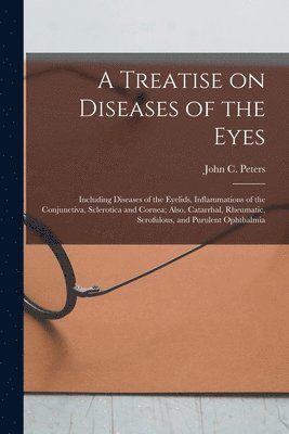 Treatise on Diseases of the Eyes; Including Diseases of the Eyelids, Inflammations of the Conjunctiva, Sclerotica and Cornea; Also, Catarrhal, Rheumatic, Scrofulous, and Purulent Ophthalmia