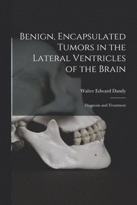 bokomslag Benign, Encapsulated Tumors in the Lateral Ventricles of the Brain