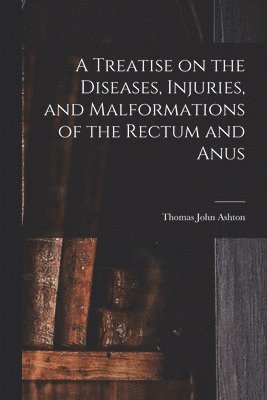 A Treatise on the Diseases, Injuries, and Malformations of the Rectum and Anus 1