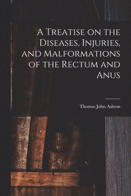 Thomas John Ashton - Treatise on the Diseases, Injuries, and Malformations of the Rectum and Anus, Häftad