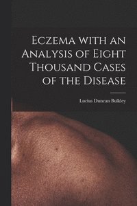 bokomslag Eczema With an Analysis of Eight Thousand Cases of the Disease