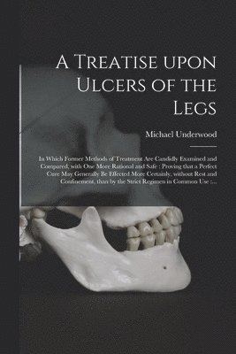 Michael 1736-1820 Underwood, Michael Underwood - Treatise Upon Ulcers of the Legs, Häftad