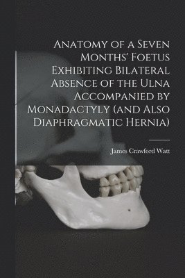 Anatomy of a Seven Months' Foetus Exhibiting Bilateral Absence of the Ulna Accompanied by Monadactyly (and Also Diaphragmatic Hernia) [microform] 1