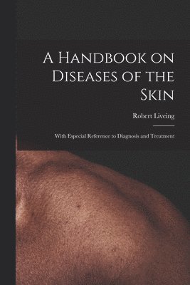 bokomslag A Handbook on Diseases of the Skin [electronic Resource]