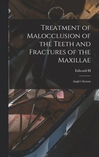 bokomslag Treatment of Malocclusion of the Teeth and Fractures of the Maxillae