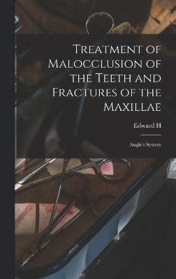 Treatment of Malocclusion of the Teeth and Fractures of the Maxillae 1