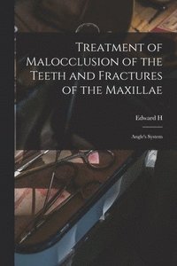 bokomslag Treatment of Malocclusion of the Teeth and Fractures of the Maxillae