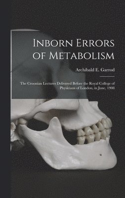 Inborn Errors of Metabolism; the Croonian Lectures Delivered Before the Royal College of Physicians of London, in June, 1908 1