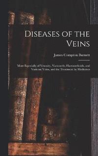 bokomslag Diseases of the Veins