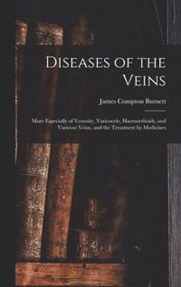 bokomslag Diseases of the Veins