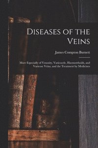 bokomslag Diseases of the Veins