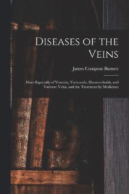 Diseases of the Veins