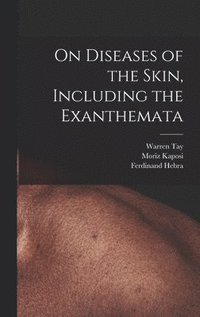 bokomslag On Diseases of the Skin, Including the Exanthemata