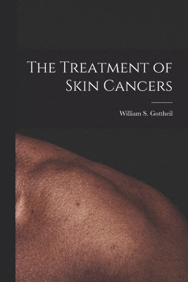 bokomslag The Treatment of Skin Cancers