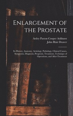 Enlargement of the Prostate