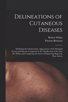 bokomslag Delineations of Cutaneous Diseases