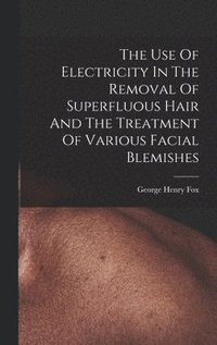 bokomslag The Use Of Electricity In The Removal Of Superfluous Hair And The Treatment Of Various Facial Blemishes