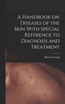 bokomslag A Handbook on Diseases of the Skin With Special Reference to Diagnosis and Treatment