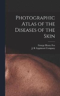 bokomslag Photographic Atlas of the Diseases of the Skin