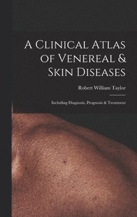 bokomslag A Clinical Atlas of Venereal & Skin Diseases