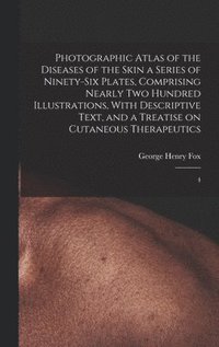 bokomslag Photographic Atlas of the Diseases of the Skin a Series of Ninety-six Plates, Comprising Nearly two Hundred Illustrations, With Descriptive Text, and a Treatise on Cutaneous Therapeutics
