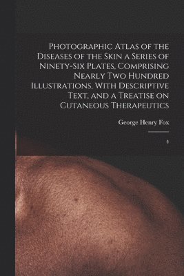 bokomslag Photographic Atlas of the Diseases of the Skin a Series of Ninety-six Plates, Comprising Nearly two Hundred Illustrations, With Descriptive Text, and a Treatise on Cutaneous Therapeutics